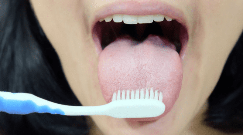 Saburra Lingual: Entenda Por Que a Língua Fica Branca