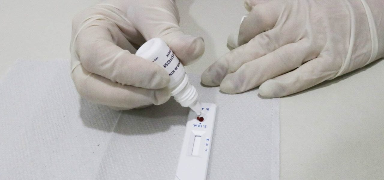 Novo Coronavírus Descoberto na China: O Que Já Se Sabe Sobre o HKU5-CoV-2