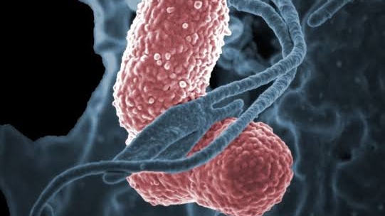 IA do Google desvenda em 48 horas mistério de superbactérias que desafiou cientistas por uma década