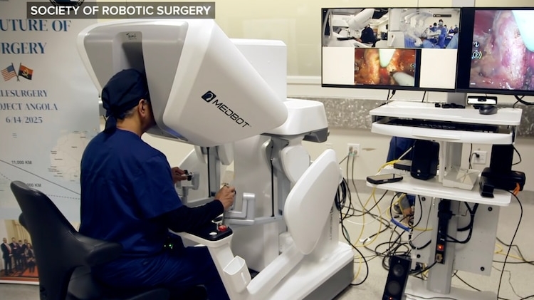 Cirurgia Robótica Transcontinental: Médico nos EUA Opera Paciente na África