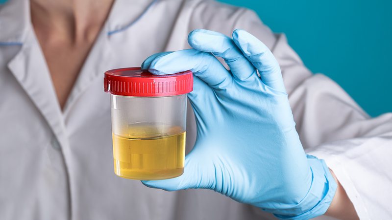 Urina é transformada em matéria-prima para implantes dentários e promete revolução ecológica