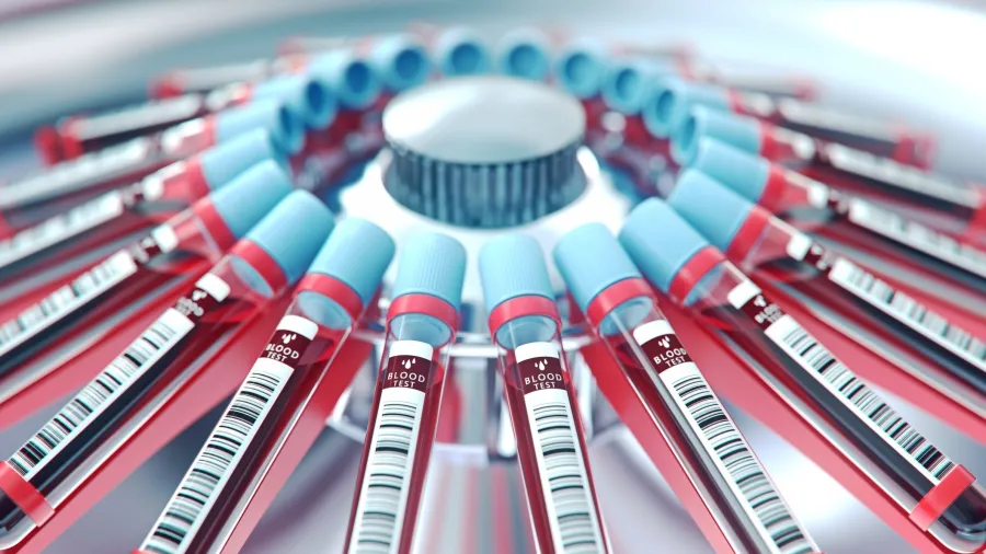 Exame de sangue desenvolvido no Brasil detecta Alzheimer com 90% de precisão